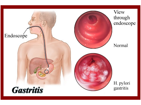 Disease 7